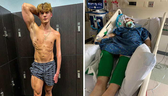 19-Year-Old Stuns People Online After Revealing Reason Why Right Arm Bigger Than His Left
