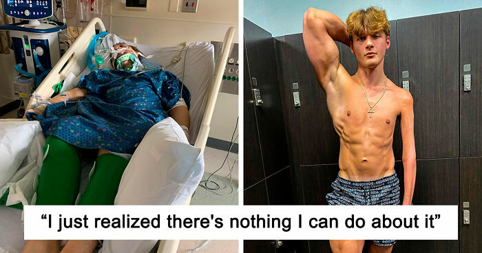 19-Year-Old Stuns People Online After Revealing Reason Why Right Arm Bigger Than His Left