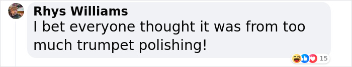 19-Year-Old Stuns People Online After Revealing Reason Why Right Arm Bigger Than His Left 19-Year-Old Stuns People Online After Revealing Reason Why Right Arm Bigger Than His Left