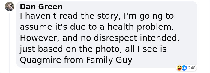 19-Year-Old Stuns People Online After Revealing Reason Why Right Arm Bigger Than His Left 19-Year-Old Stuns People Online After Revealing Reason Why Right Arm Bigger Than His Left