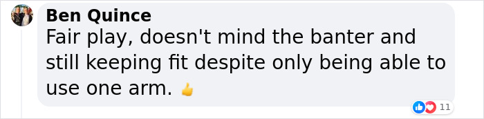 19-Year-Old Stuns People Online After Revealing Reason Why Right Arm Bigger Than His Left 19-Year-Old Stuns People Online After Revealing Reason Why Right Arm Bigger Than His Left