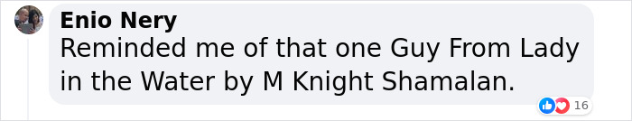 19-Year-Old Stuns People Online After Revealing Reason Why Right Arm Bigger Than His Left 19-Year-Old Stuns People Online After Revealing Reason Why Right Arm Bigger Than His Left