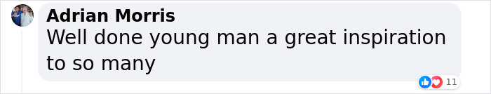 "It's So Surreal": 14-Year-Old Invents Soap That Treats Skin Cancer And Wins Science Award "It's So Surreal": 14-Year-Old Invents Soap That Treats Skin Cancer And Wins Science Award