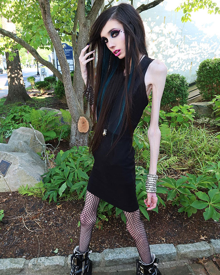 "Really Heartbreaking": Cops Flooded With Calls Over Eugenia Cooney's Alarming Appearance
