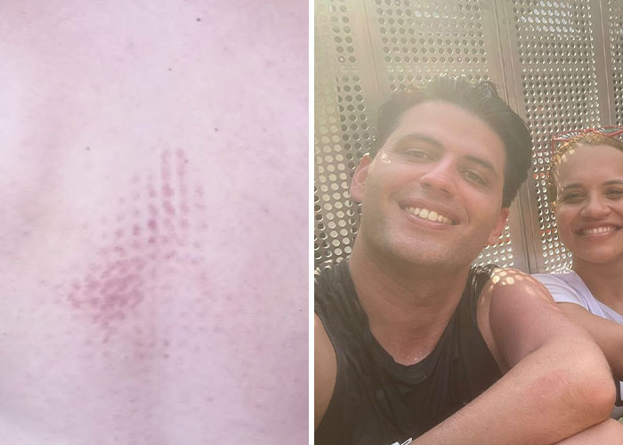 Fans Suffered From “Second-Degree Burns” At Taylor Swift’s Show Where Conditions Were “Inhumane”
