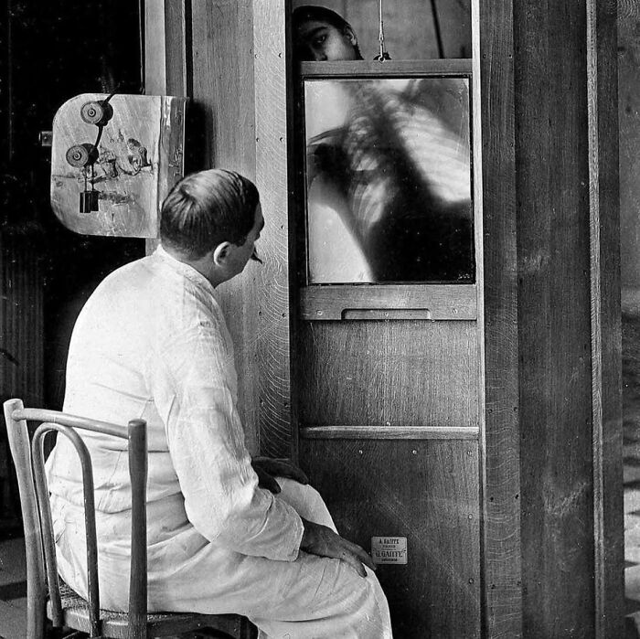 Capturada en 1914, esta imagen muestra una radiografía de tórax tomada en la División de Radiología del Dr. Maxime Menard en el Hospital Cochin de París.