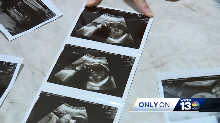 Woman With Double Uterus Is Expecting A Baby In Both, Twin Daughters Could Be Born Weeks Apart Woman With Double Uterus Is Expecting A Baby In Both, Twin Daughters Could Be Born Weeks Apart