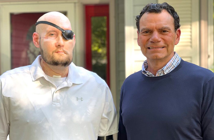 “I Don’t Want To Wear A Mask”: Veteran Who Lost Half Of His Face Receives Eyeball Transplant