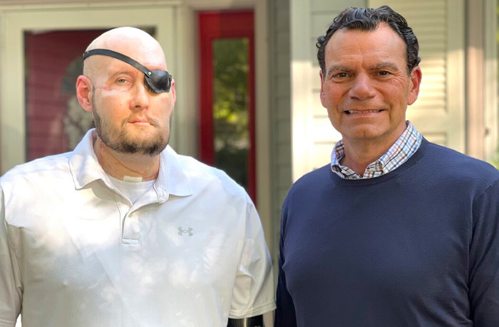 “I Don’t Want To Wear A Mask”: Veteran Who Lost Half Of His Face Receives Eyeball Transplant “I Don’t Want To Wear A Mask”: Veteran Who Lost Half Of His Face Receives Eyeball Transplant