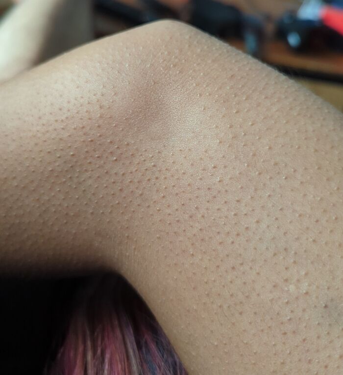This Specific Spot On My Girlfriend's Elbow Doesn't Get Goosebumps