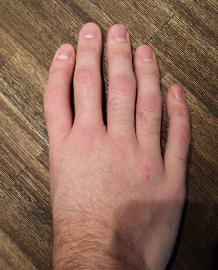 I Give You 5 Fingers