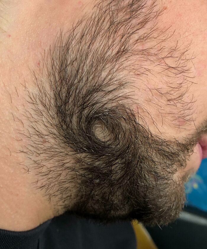 My Boyfriend's Beard Hair Grows In Like A Hurricane Pattern