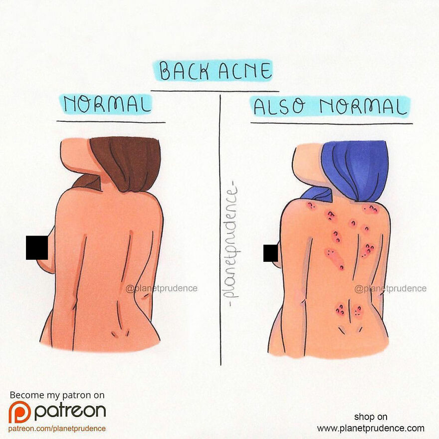 Relatable Comics That Beautifully Depicts Girl’s Everyday Problems (New Pics)