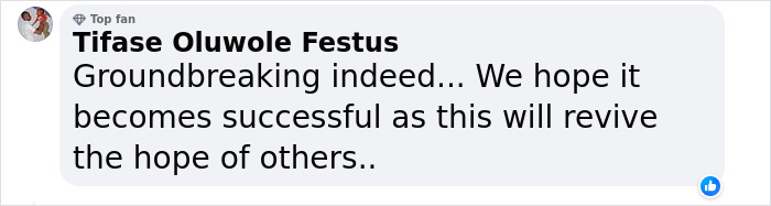 “I Don’t Want To Wear A Mask”: Veteran Who Lost Half Of His Face Receives Eyeball Transplant “I Don’t Want To Wear A Mask”: Veteran Who Lost Half Of His Face Receives Eyeball Transplant