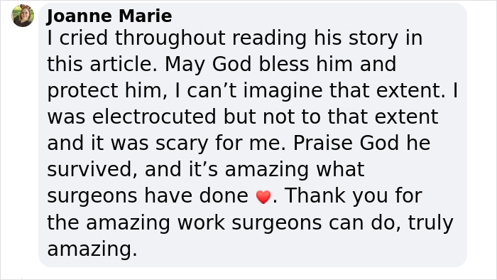 “I Don’t Want To Wear A Mask”: Veteran Who Lost Half Of His Face Receives Eyeball Transplant “I Don’t Want To Wear A Mask”: Veteran Who Lost Half Of His Face Receives Eyeball Transplant