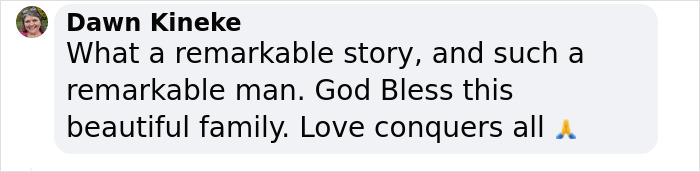 “I Don’t Want To Wear A Mask”: Veteran Who Lost Half Of His Face Receives Eyeball Transplant “I Don’t Want To Wear A Mask”: Veteran Who Lost Half Of His Face Receives Eyeball Transplant