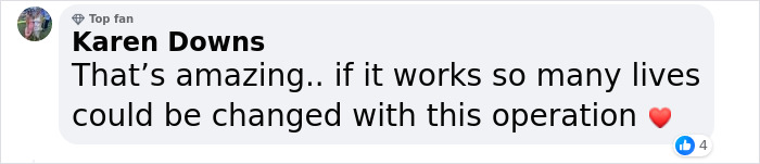 “I Don’t Want To Wear A Mask”: Veteran Who Lost Half Of His Face Receives Eyeball Transplant “I Don’t Want To Wear A Mask”: Veteran Who Lost Half Of His Face Receives Eyeball Transplant