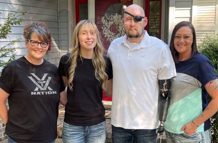 “I Don’t Want To Wear A Mask”: Veteran Who Lost Half Of His Face Receives Eyeball Transplant “I Don’t Want To Wear A Mask”: Veteran Who Lost Half Of His Face Receives Eyeball Transplant