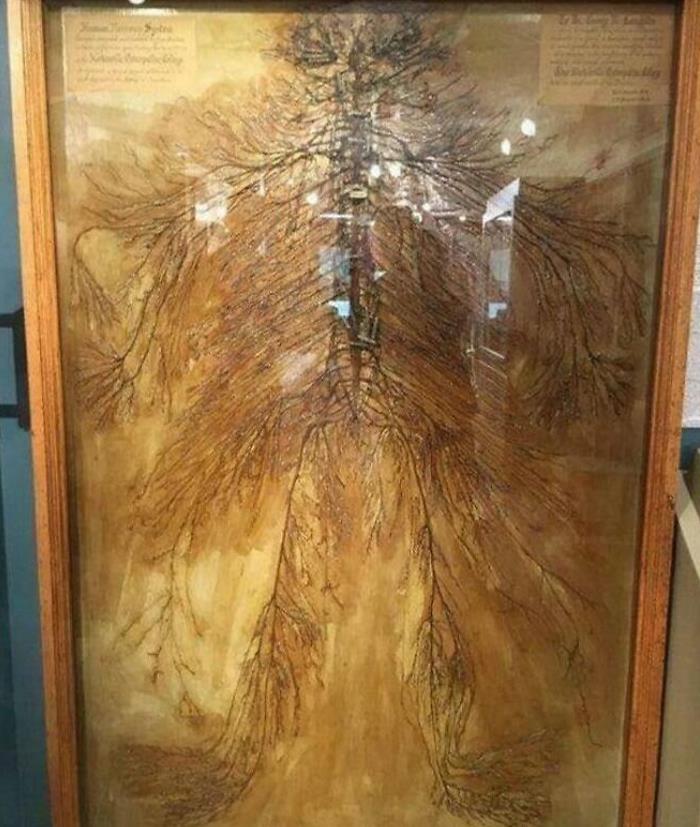 This Is A Human Nervous System That Took Over 4000 Hours To Dissect. There Is Only 4 In The World