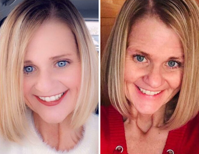 I Think She Just Discovered Facetune. (Right Is A Normal Selfie)