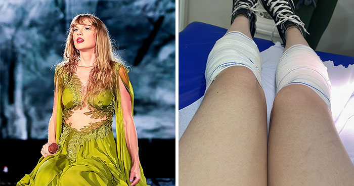 Fans Suffered From “Second-Degree Burns” At Taylor Swift’s Show Where Conditions Were “Inhumane”