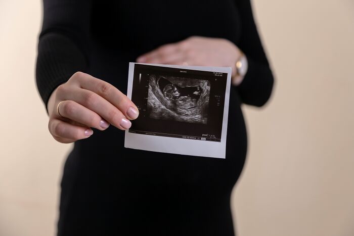 30 Cases Of Women Being Ignorant About A Baby Growing Inside Of Them, As Shared Online