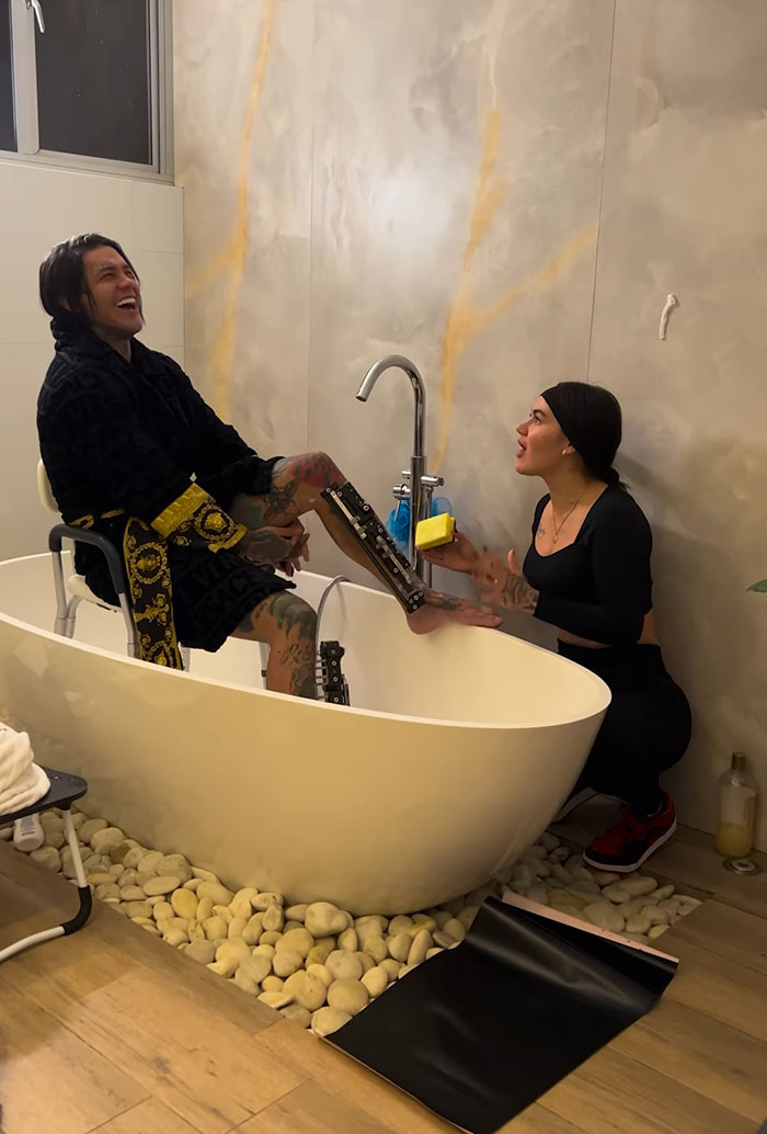 Influencer Spends $175,000 On “Most Painful” Leg-Lengthening Surgery To Grow Six Inches Influencer Spends $175,000 On “Most Painful” Leg-Lengthening Surgery To Grow Six Inches