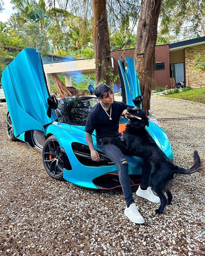 Influencer Spends $175,000 On “Most Painful” Leg-Lengthening Surgery To Grow Six Inches Influencer Spends $175,000 On “Most Painful” Leg-Lengthening Surgery To Grow Six Inches