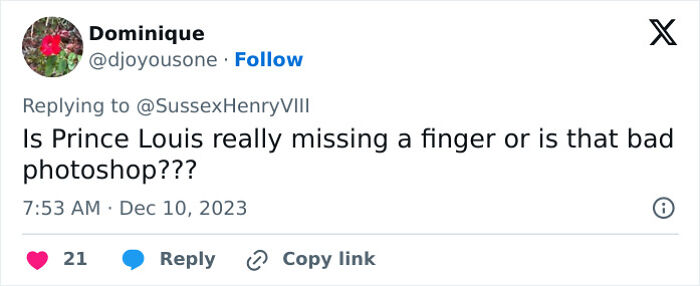 “Worst Photoshopped Pic”: People Left Confused By Prince Louis In Royal Family’s Christmas Photo “Worst Photoshopped Pic”: People Left Confused By Prince Louis In Royal Family’s Christmas Photo