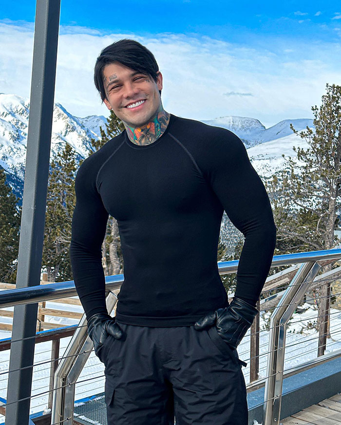 Influencer Spends $175,000 On “Most Painful” Leg-Lengthening Surgery To Grow Six Inches Influencer Spends $175,000 On “Most Painful” Leg-Lengthening Surgery To Grow Six Inches