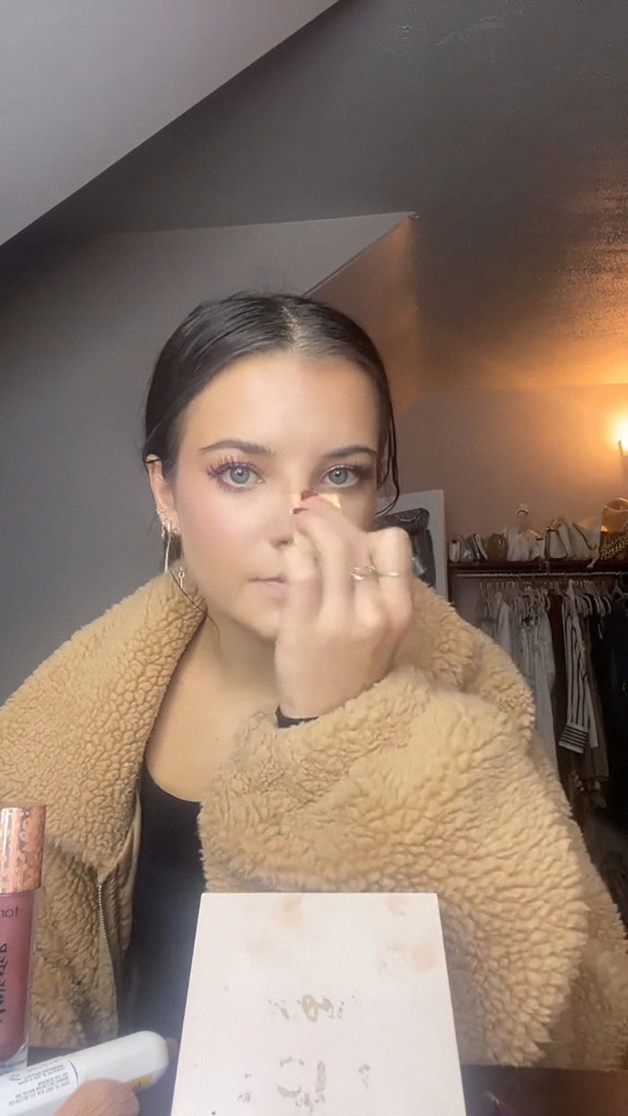 Fans Urge Brooke Hyland To Seek Medical Care After Showing Her “Triangle Of Death” Pimple