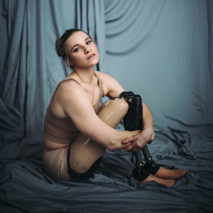 Woman Adopts Abandoned Disabled Child, Nurtures Her Into A World-Class Athlete Woman Adopts Abandoned Disabled Child, Nurtures Her Into A World-Class Athlete