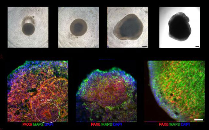 “Things Are About To Get Weird”: Scientists Use Human Brain Cells On Chip, It Can Now Do Simple Math