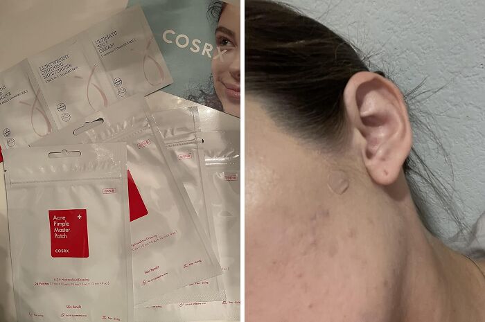 Pimple Beware: Cosrx Acne Pimple Patch - Kiss Blemishes Goodbye And Hello To Clear Skin Days. 'Patch'ing Things Up Never Felt So Good