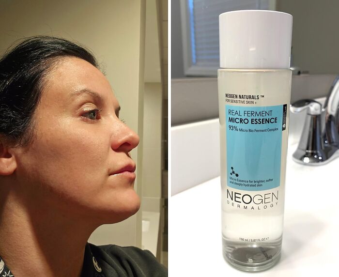 Micro Magic For Your Skin: Drench Your Face In Dermalogy's Real Ferment Micro Essence - The Daily Dose Your Skin Craves For True Radiance