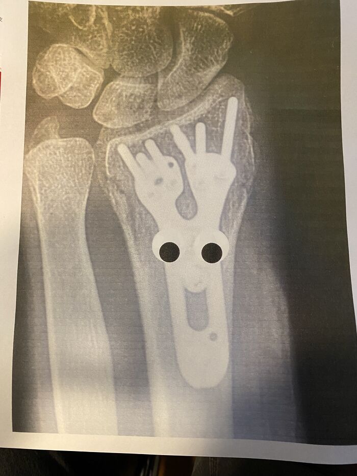 I Put Googly Eyes On My Roommate’s X-Ray