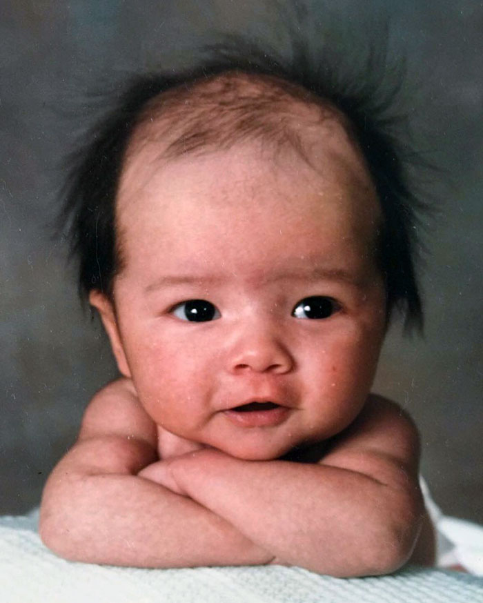 When I Was Born, I Looked Like An 87-Year-Old Man