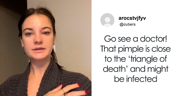 Fans Urge Brooke Hyland To Seek Medical Care After Showing Her “Triangle Of Death” Pimple