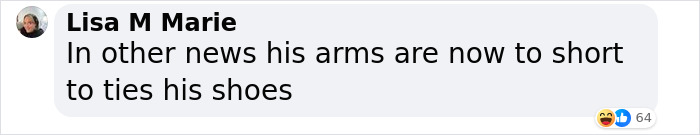 Influencer Spends $175,000 On “Most Painful” Leg-Lengthening Surgery To Grow Six Inches Influencer Spends $175,000 On “Most Painful” Leg-Lengthening Surgery To Grow Six Inches