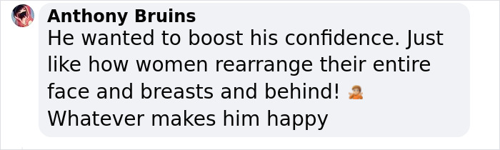 Influencer Spends $175,000 On “Most Painful” Leg-Lengthening Surgery To Grow Six Inches Influencer Spends $175,000 On “Most Painful” Leg-Lengthening Surgery To Grow Six Inches