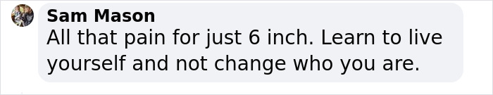 Influencer Spends $175,000 On “Most Painful” Leg-Lengthening Surgery To Grow Six Inches Influencer Spends $175,000 On “Most Painful” Leg-Lengthening Surgery To Grow Six Inches