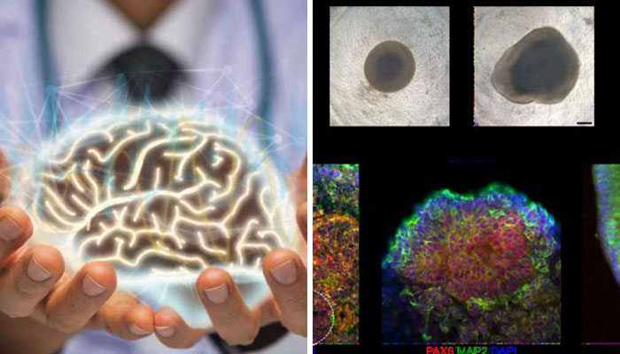 “Things Are About To Get Weird”: Scientists Use Human Brain Cells On Chip, It Can Now Do Simple Math