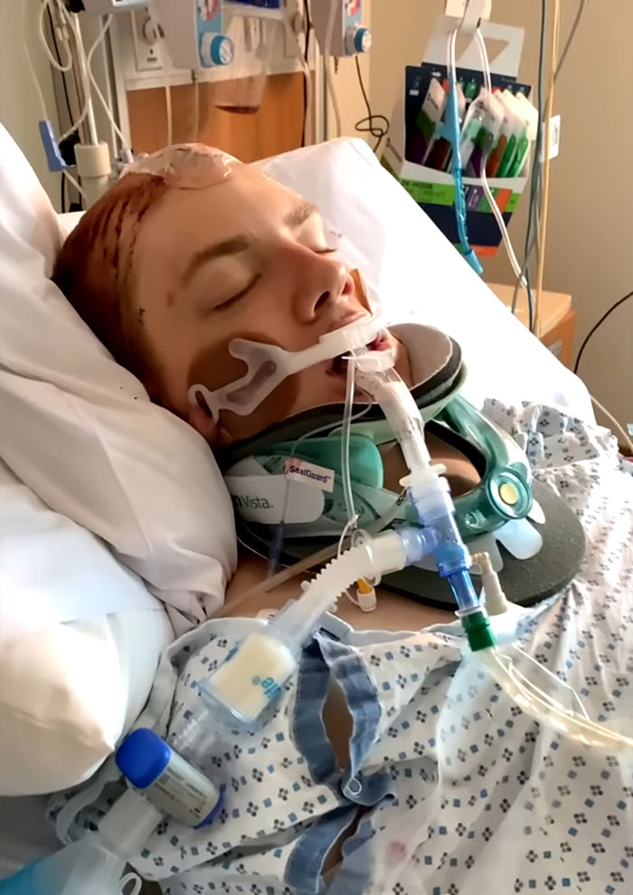 Man Who Underwent Skull Removal Surgeries To “Wash” His Brain Gets Denied Disability Benefits Man Who Underwent Skull Removal Surgeries To “Wash” His Brain Gets Denied Disability Benefits