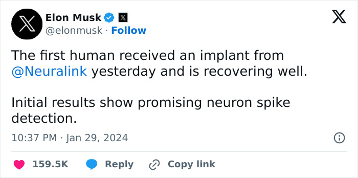 “That Is The Goal”: Elon Musk’s Neuralink Is Implanted In First-Ever Human “That Is The Goal”: Elon Musk’s Neuralink Is Implanted In First-Ever Human