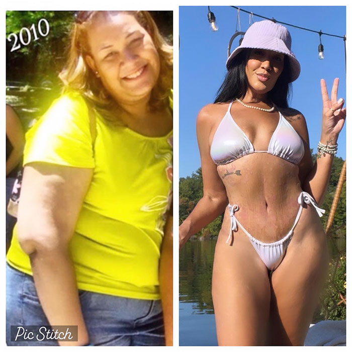 Weight Loss Influencer Mila De Jesus, Who Went Viral For Her Transformation, Passes Away At 35 Weight Loss Influencer Mila De Jesus, Who Went Viral For Her Transformation, Passes Away At 35