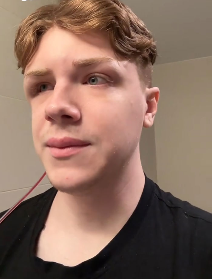 Man Who Underwent Skull Removal Surgeries To “Wash” His Brain Gets Denied Disability Benefits Man Who Underwent Skull Removal Surgeries To “Wash” His Brain Gets Denied Disability Benefits