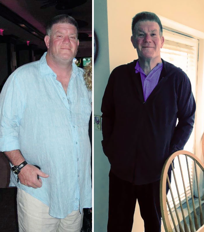 9 Months Ago, My 58-Year-Old Father Was 340 Lbs. He Had Type II Diabetes And Had Heart Surgery. After A Change In Diet And Exercise, He Has Reversed His Diabetes And Is Currently 237 Lbs