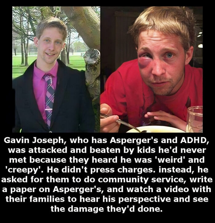 Gavin Joseph Assaulted For Having Asperger’s And Adhd By Kids, Because They Heard He Was “Weird” And “Creepy”