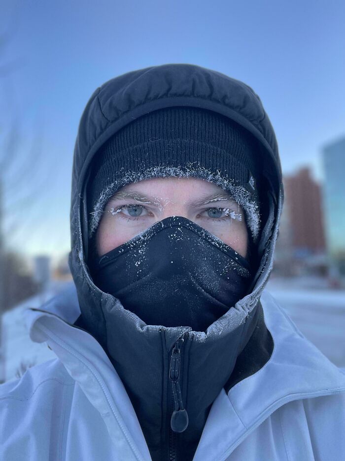 It’s Pretty Cold In Calgary, Canada. -32°c!