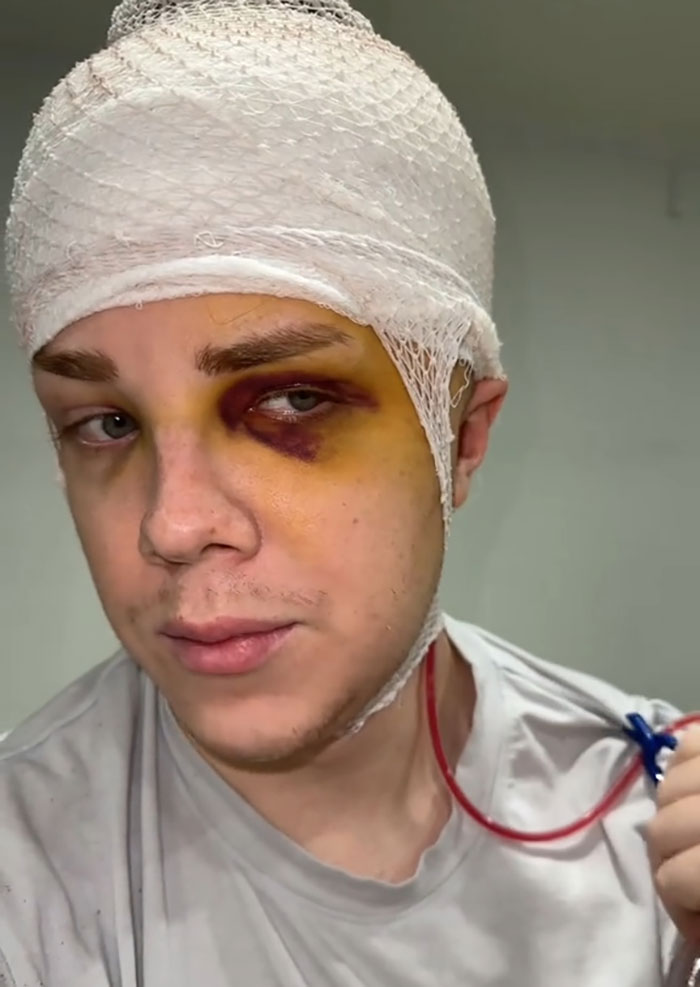 Man Who Underwent Skull Removal Surgeries To “Wash” His Brain Gets Denied Disability Benefits Man Who Underwent Skull Removal Surgeries To “Wash” His Brain Gets Denied Disability Benefits